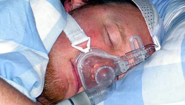 Britský chovatel papoušků skončil s „chřipkou“ v nemocnici, tam mu zjistili psitakózu